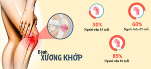 chữa bệnh đau xương khớp