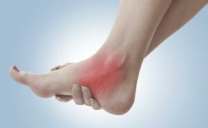 chữa mắt cá chân bằng ngải cứu