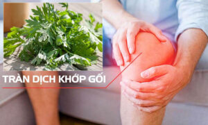 chữa tràn dịch khớp gối bằng ngải cứu